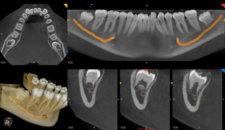 CBCT Services
