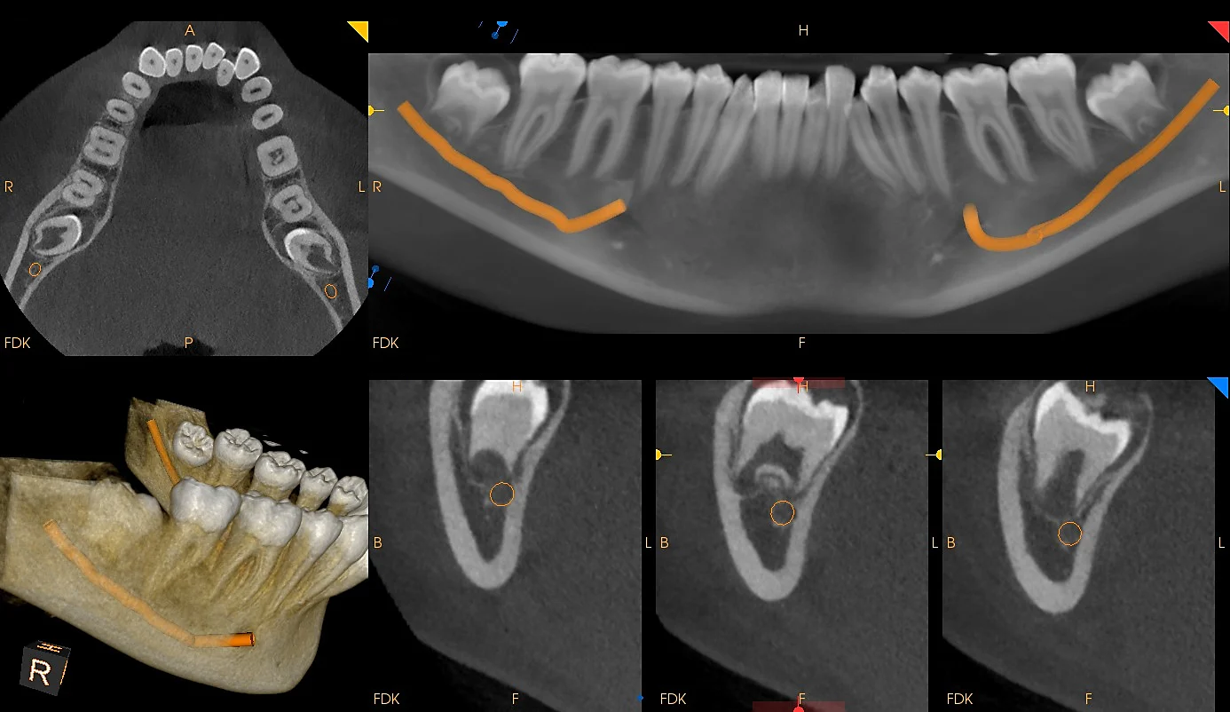 CBCT View 2