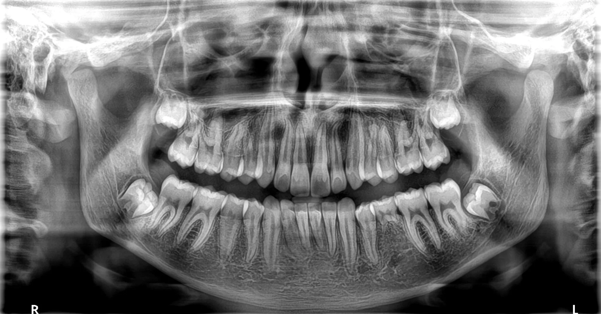 Orthopantomogram